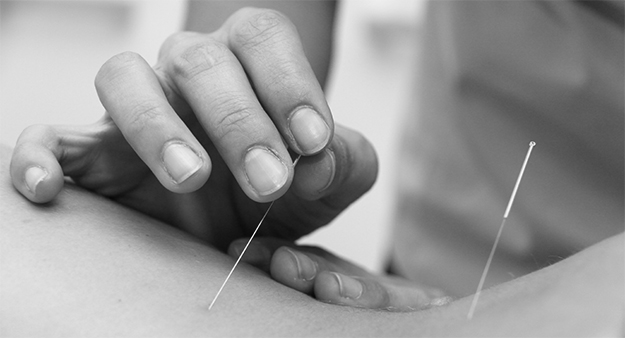 Homem aplicando acupuntura